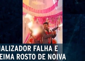 Acidente acontece com noiva que tem rosto queimado após brincadeira pirotécnica falhar