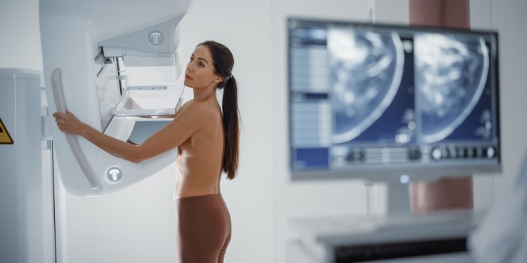 Desinformação prejudica prevenção do câncer de mama, revela pesquisa